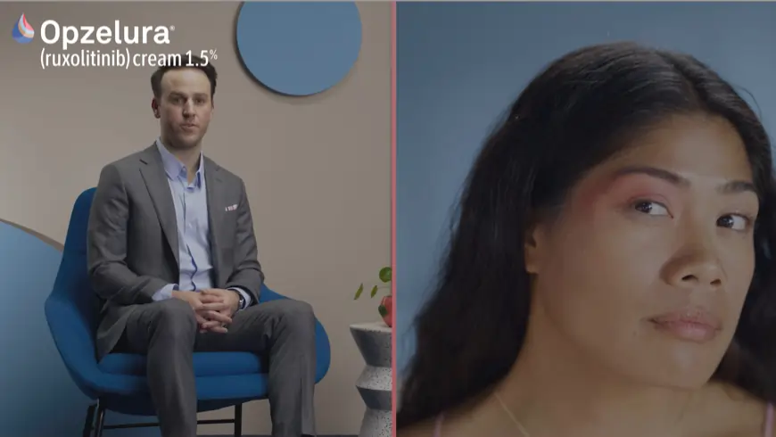 Managing flares with OPZELURA video