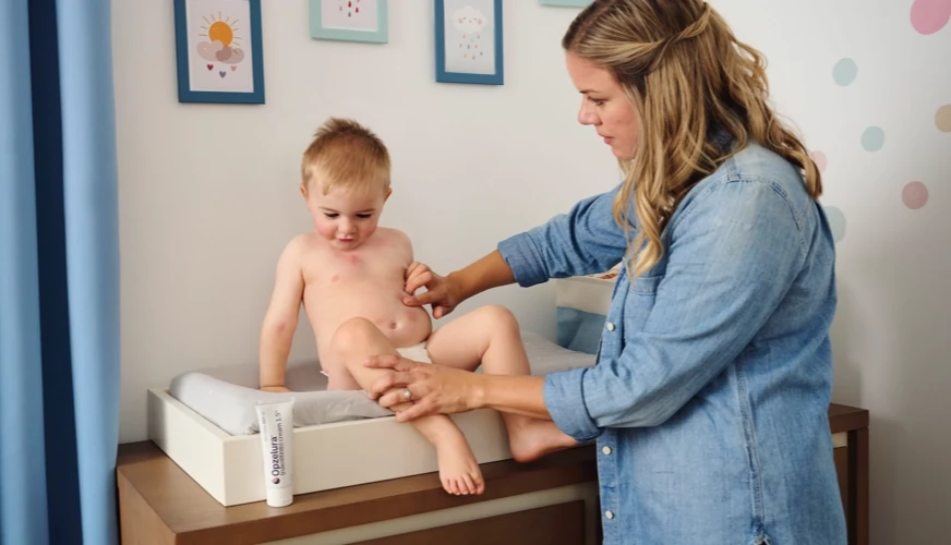 How do you use opzelura page