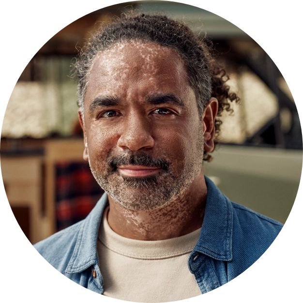 Patient's face before treatment with OPZELURA