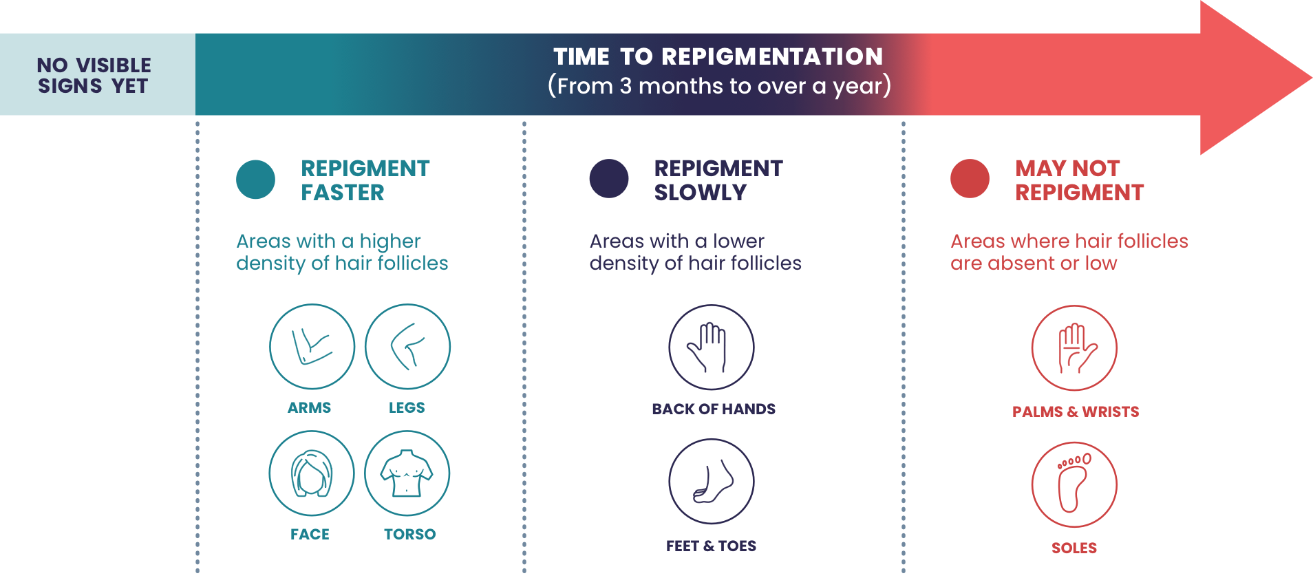 Time to repigmentation chart for different areas of the body, based on hair follicle density